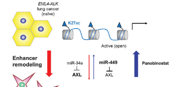 New research suggests cause of drug resistance in subset of lung cancer patients